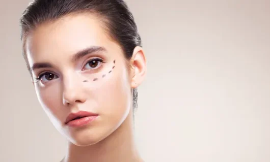 dark-circles-under-eyes-01.webp dark-circles-under-eyes-01.webp