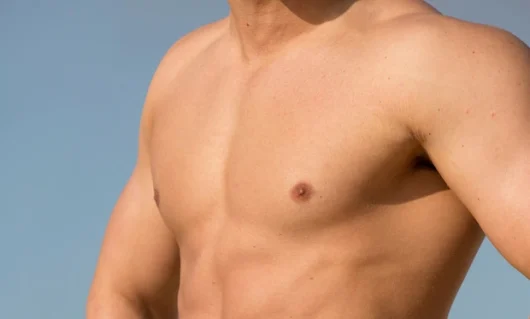 gynecomastia-02