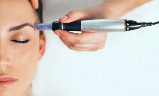 mesotherapy-01.webp mesotherapy-01.webp