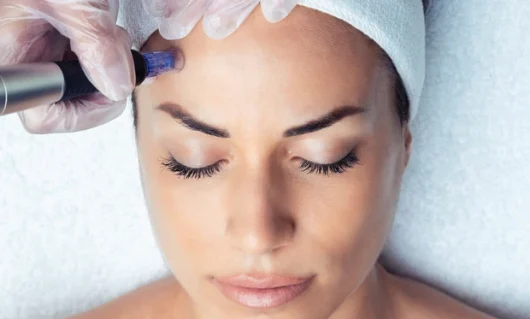 mesotherapy-03.webp mesotherapy-03.webp