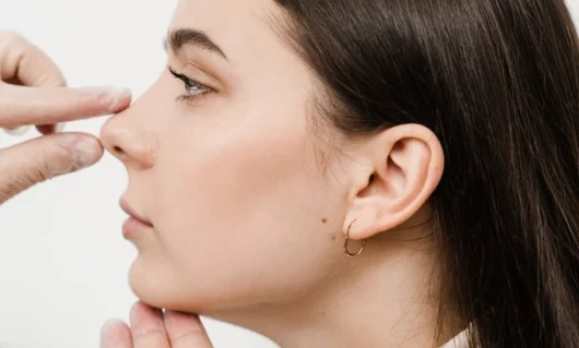 non-surgical-rhinoplasty-01 non-surgical-rhinoplasty-01