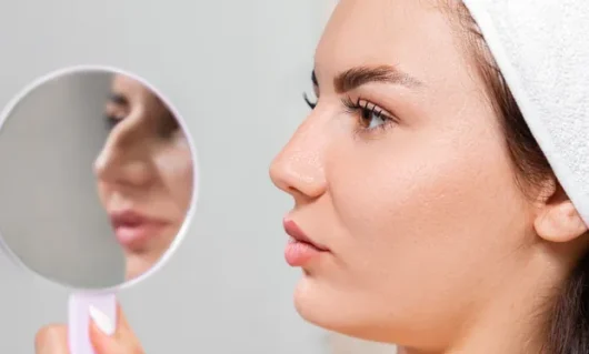 rhinoplasty-01 rhinoplasty-01