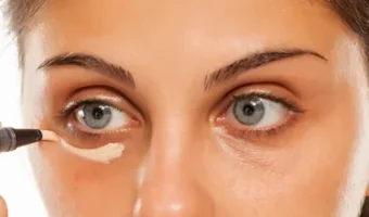 services-redensity-under-eye-light-filling services-redensity-under-eye-light-filling