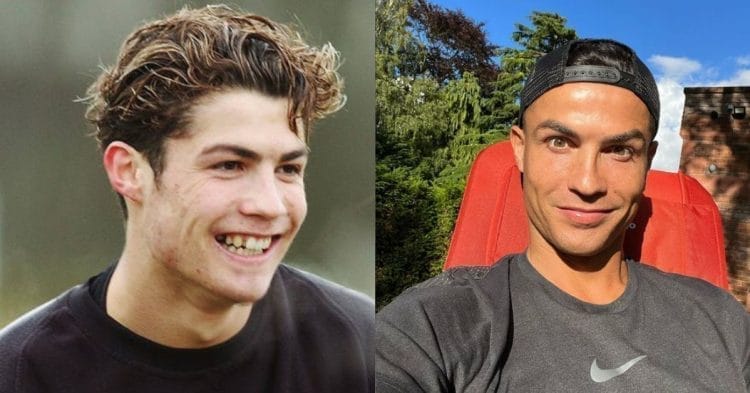 cristiano ronaldo before after
