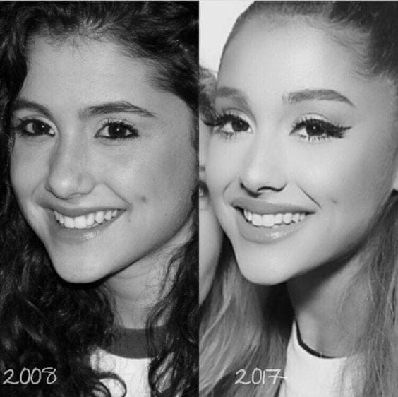 Ariana Grande’s Before and After