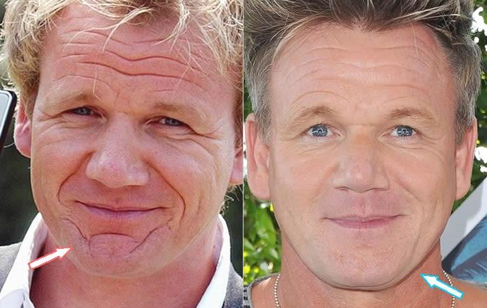 Gordon Ramsey
