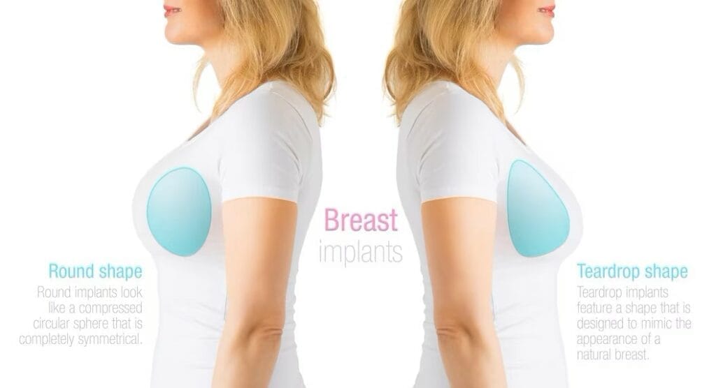 Which Breast Aesthetics Technique is Suitable for You?