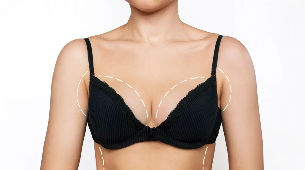 Which Breast Aesthetics Technique is Suitable for You?