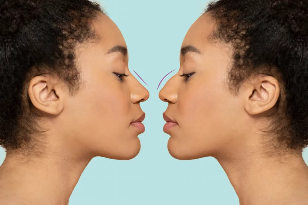 How to Choose a Doctor for Facial Aesthetics Surgery?