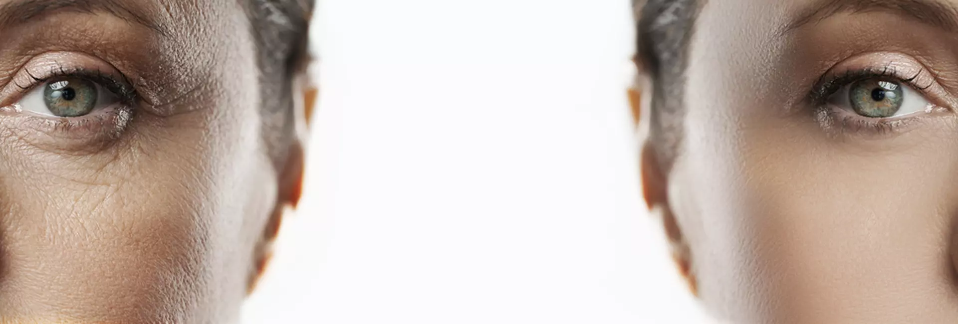 Before After Cover Letter