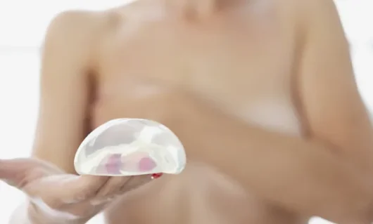 breast-augmentation-02.webp