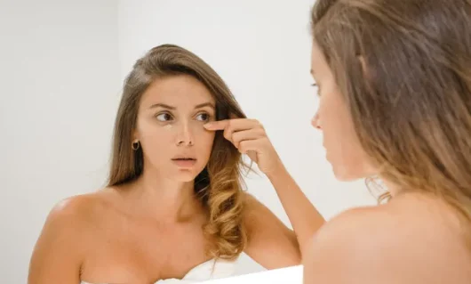 dark-circles-under-eyes-02.webp