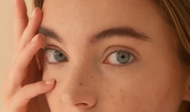 hero-canthoplasty-fox-eye-lift