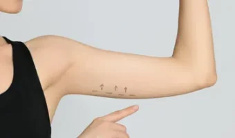 services-arm-and-leg-aesthetics