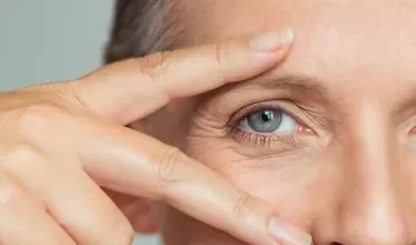 services-eyelid-surgery