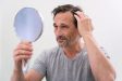 vanity-hair-loss-treatment