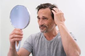 vanity-hair-loss-treatment